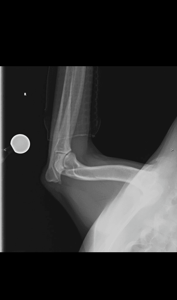 Canine Forelimb lateral radiograph — atlas reference